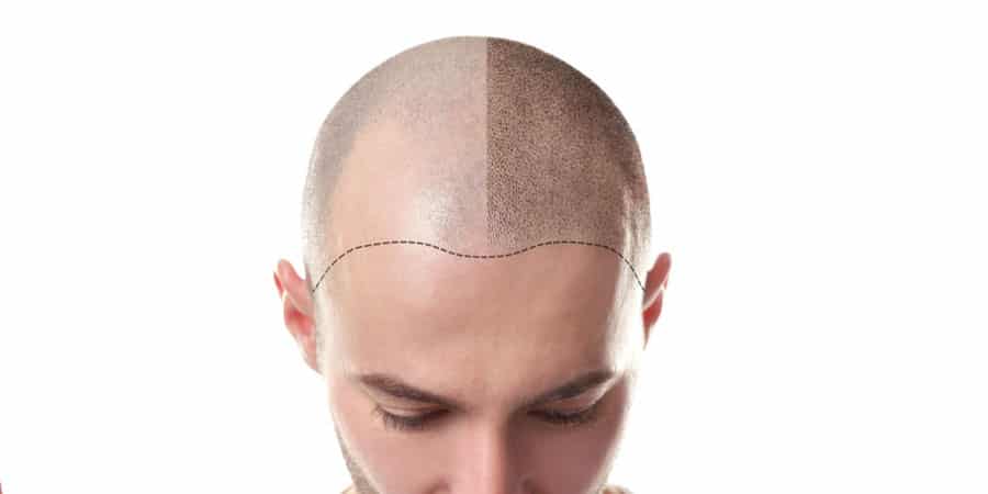 Is Hair Tattooing Right For Me